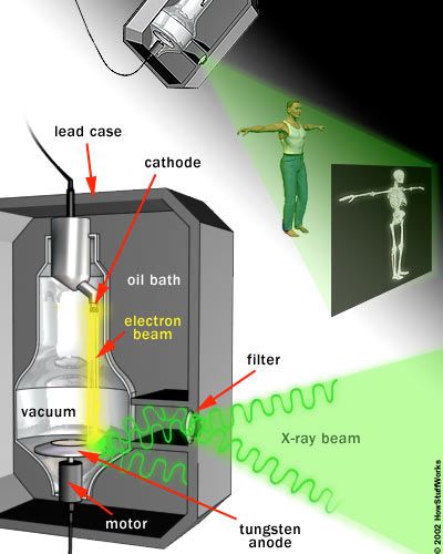 How an Xray Film Digitizer Works, Quick and Easy Explanation!