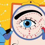 8town_eyelidsurgery-MAIN.jpg