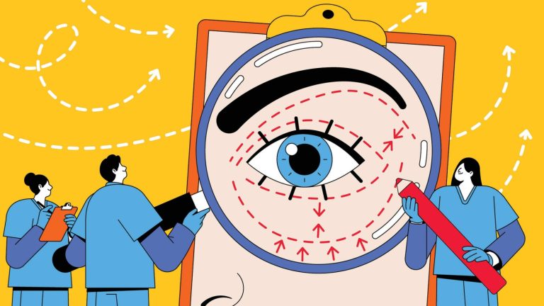 8town_eyelidsurgery-MAIN.jpg