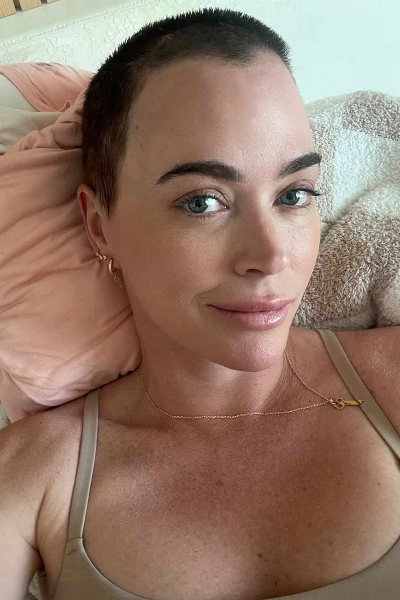 Teddi Mellencamp Recalls Her 'Darkest Days' Amid Brain Tumors Surgery